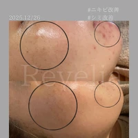画像321