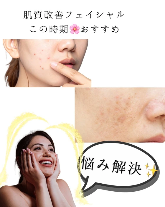 画像336